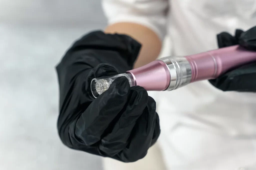 Close-up of microneedling device held with black gloves