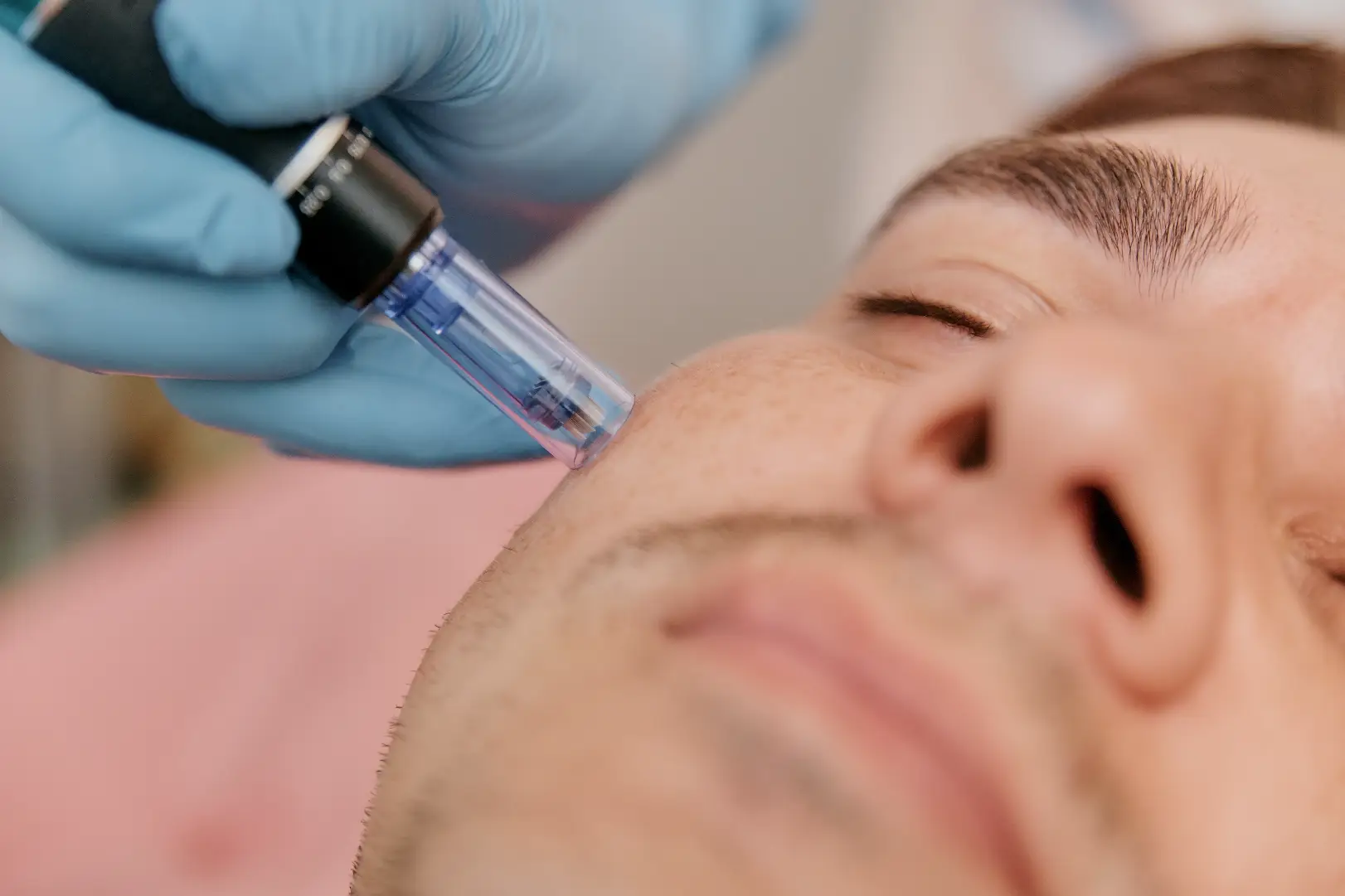 HydraFacial device applied to man's cheek during treatment