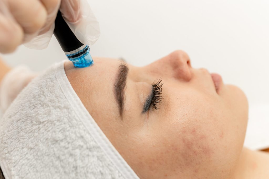 Close-up of a HydraFacial handpiece applied to a patient's forehead during treatment.