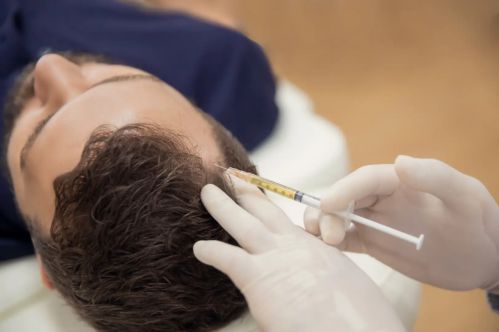Clinician injects the scalp near the hairline while the patient lies on a treatment bed.
